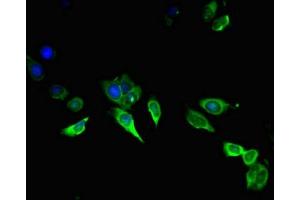 Immunofluorescent analysis of Hela cells using ABIN7144028 at dilution of 1:100 and Alexa Fluor 488-congugated AffiniPure Goat Anti-Rabbit IgG(H+L)