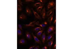 Immunofluorescence analysis of U-2 OS cells using SC antibody (ABIN7270188) at dilution of 1:100. (SCAMP2 anticorps  (AA 1-152))