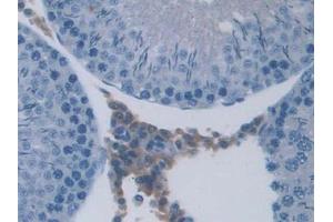 DAB staining on IHC-P; Samples: Rat Testis Tissue