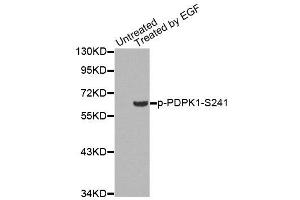Western Blotting (WB) image for anti-3-phosphoinositide Dependent Protein Kinase-1 (PDPK1) (pSer241) antibody (ABIN1870500) (PDPK1 anticorps  (pSer241))