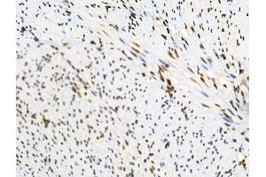 anti-Fanconi Anemia Complementation Group I (FANCI) (pSer565) antibody