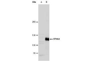 WB Image Eph receptor A4 antibody [N3C2], Internal detects Eph receptor A4 protein by western blot analysis. (EPH Receptor A4 anticorps)