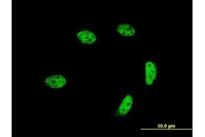 Immunofluorescence of monoclonal antibody to GTF2A1L on HeLa cell. (GTF2A1L anticorps  (AA 251-348))