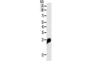 Western Blotting (WB) image for anti-C-Reactive Protein (CRP) antibody (ABIN2421438) (CRP anticorps)