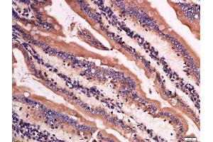 anti-Lysozyme (LYZ) antibody