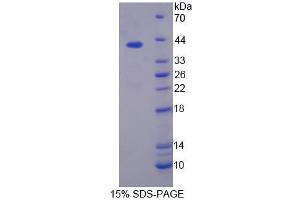 SDS-PAGE (SDS) image for Phospholipid Scramblase 4 (PLSCR4) (AA 1-299) protein (His tag) (ABIN6239437) (PLSCR4 Protein (AA 1-299) (His tag))