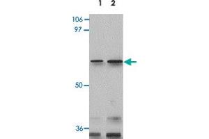 Western blot analysis of GLS2 in rat kidney tissue lysate with GLS2 polyclonal antibody  at 0. (GLS2 anticorps  (Internal Region))