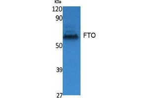 Western Blotting (WB) image for anti-Fat Mass and Obesity-Associated (FTO) (N-Term) antibody (ABIN3178067) (FTO anticorps  (N-Term))