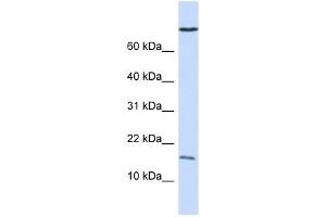 GABARAP antibody used at 1 ug/ml to detect target protein. (GABARAP anticorps)