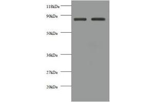 Western blot All lanes: CDH12 antibody at 2 μg/mL Lane 1: EC109 whole cell lysate Lane 2: 293T whole cell lysate Secondary Goat polyclonal to rabbit IgG at 1/10000 dilution Predicted band size: 89, 85 kDa Observed band size: 85 kDa (Cadherin 12 anticorps  (AA 56-605))