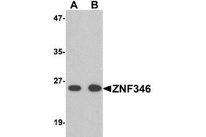 Western blot analysis of TRIP6 in EL4 cell lysate with TRIP6 antibody at 1 μg/ml. (ZNF346 anticorps  (N-Term))