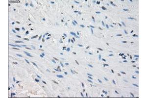 Image no. 8 for anti-Protein Phosphatase 5, Catalytic Subunit (PPP5C) antibody (ABIN1500390)