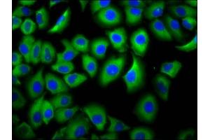 Immunofluorescence staining of A549 cells with ABIN7158551 at 1:66, counter-stained with DAPI. (FCGR3B anticorps  (AA 18-125))