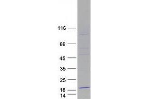 Validation with Western Blot