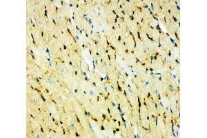 IHC-P: FABP5 antibody testing of mouse heart
