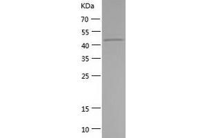 Western Blotting (WB) image for Synaptotagmin XIII (SYT13) (AA 30-426) protein (His-IF2DI Tag) (ABIN7125278)