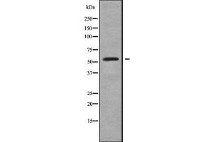 Western blot analysis GABRR2 using LOVO whole cell lysates (GABRR2 anticorps  (Internal Region))