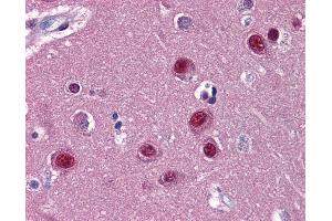 Anti-NR1D1 antibody IHC of human brain, cortex.