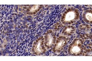 Detection of CBX3 in Mouse Uterus Tissue using Polyclonal Antibody to Chromobox Homolog 3 (CBX3)