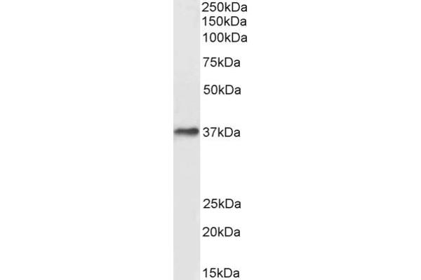 DARC anticorps  (N-Term)