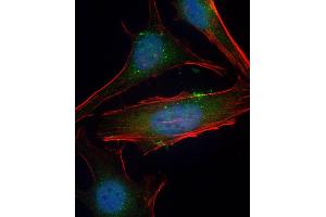 Immunofluorescent analysis of 4 % paraformaldehyde-fixed, 0.