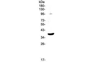 Western blot testing of mouse HEPA1-6 cell lysate with SCF antibody at 0. (KIT Ligand anticorps)