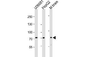 Western blot analysis of lysates from U266B1,HepG2 cell line,mouse brain tissue lysate(from left to right), using NT5E- Antibody (ABIN388750 and ABIN2839011).