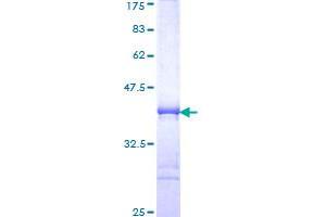 Image no. 1 for Mex-3 Homolog B (MEX3B) (AA 60-159) protein (GST tag) (ABIN1310774)