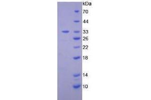 Image no. 1 for Diacylglycerol Kinase, epsilon 64kDa (DGKE) (AA 243-502) (Active) protein (His tag) (ABIN6239838)