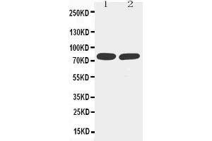 Anti-TNF Receptor II antibody, Western blotting Lane 1: MM453 Cell Lysate Lane 2: JURKAT Cell Lysate (TNFRSF1B anticorps  (Middle Region))