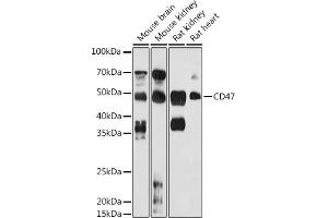 Western blot analysis of extracts of various cell lines, using CD47 antibody (ABIN6127604, ABIN6138199, ABIN6138201 and ABIN6223104) at 1:1000 dilution. (CD47 anticorps  (AA 20-140))