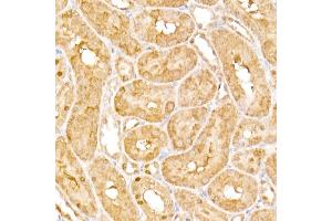 Immunohistochemistry of paraffin-embedded rat kidney using B1 Rabbit pAb (ABIN6129916, ABIN6136962, ABIN6136963 and ABIN6222795) at dilution of 1:150 (40x lens).