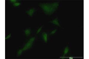Immunofluorescence of monoclonal antibody to KLK3 on A-549 cell. (Prostate Specific Antigen anticorps  (AA 1-261))