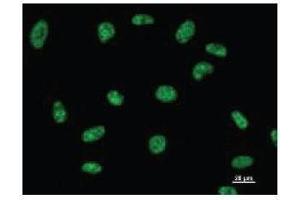 Immunostaining analysis in HeLa cells. (DDX39 anticorps)