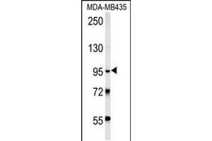 Western blot analysis in MDA-MB435 cell line lysates (15ug/lane). (TRHDE anticorps  (C-Term))