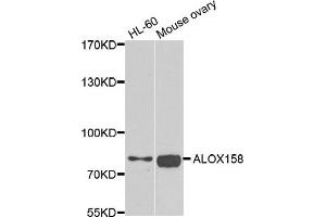 Western blot analysis of extracts of HL60 and mouse ovary cell lines, using ALOX15B antibody.