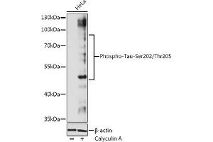 Western blot analysis of extracts of Hela cells, using Phospho-Tau-Ser202/Thr205 antibody (ABIN7268525) at 1:1000 dilution. (MAPT anticorps  (pSer202, pThr205))