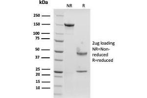SDS-PAGE Analysis Purified Langerin Recombinant Mouse Monoclonal Antibody (rLGRN/1821). (Recombinant CD207 anticorps  (AA 74-213))