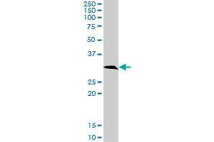 KHK MaxPab rabbit polyclonal antibody. (Ketohexokinase anticorps  (AA 1-298))