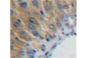 Used in DAB staining on fromalin fixed paraffin-embedded Liver tissue
