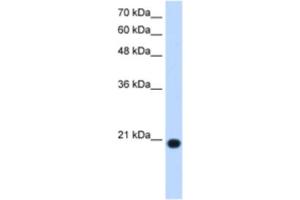 Western Blotting (WB) image for anti-Ubiquitously-Expressed, Prefoldin-Like Chaperone (UXT) antibody (ABIN2463113) (UXT anticorps)