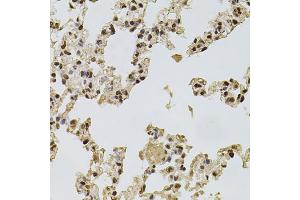 Immunohistochemistry of paraffin-embedded rat lung using FGF2 antibody (ABIN1872685) at dilution of 1:100 (40x lens). (FGF2 anticorps)