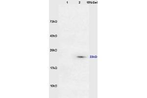 Lane 1: mouse lung lysates Lane 2: mouse intestine lysates probed with Anti DARPP32 Polyclonal Antibody, Unconjugated (ABIN680323) at 1:200 in 4 °C. (DARPP32 anticorps  (AA 51-150))