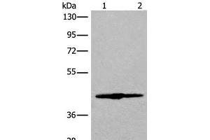 Western blot analysis of 293T cell lysate using IVD Polyclonal Antibody at dilution of 1:500 (IVD anticorps)