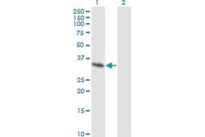 Western Blot analysis of SPRY2 expression in transfected 293T cell line by SPRY2 monoclonal antibody (M01), clone 1E10.