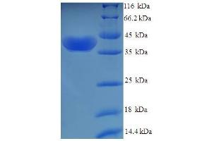 SDS-PAGE (SDS) image for Uridine-Cytidine Kinase 1 (UCK1) (AA 1-201), (Isoform 2) protein (His-SUMO Tag) (ABIN5710592)