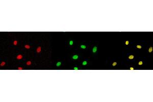 Immunofluorescence (IF) image for anti-Tumor Protein P53 (TP53) (pSer315) antibody (ABIN3201006) (p53 anticorps  (pSer315))