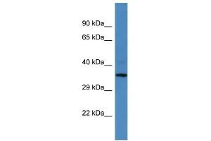 Western Blotting (WB) image for anti-MLF1 Interacting Protein (MLF1IP) (N-Term) antibody (ABIN2788059)
