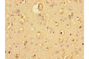 Immunohistochemistry of paraffin-embedded human brain tissue using ABIN7174530 at dilution of 1:100 (UBA6 anticorps  (AA 1-44))