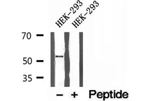 Western blot analysis of extracts of HEK-293 cells, using BCS1L antibody. (BCS1L anticorps  (Internal Region))